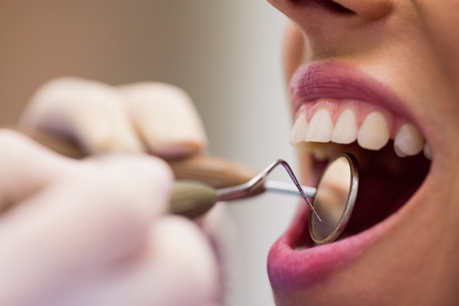 close up of dentist examining a female patient with tools at dental clinic
